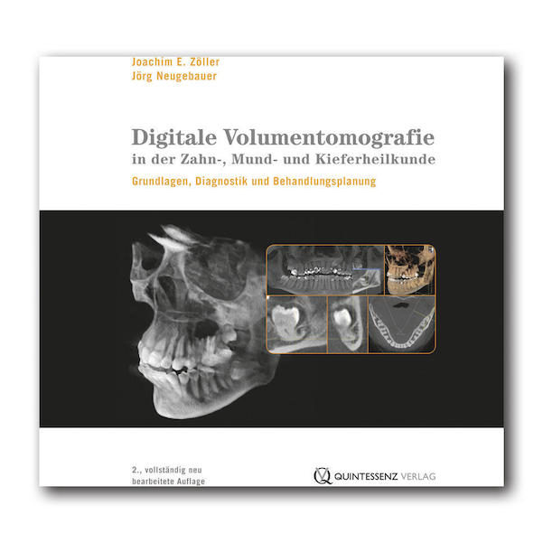 Digitale Volumentomografie in der Zahn-, Mund- und Kieferheilkunde