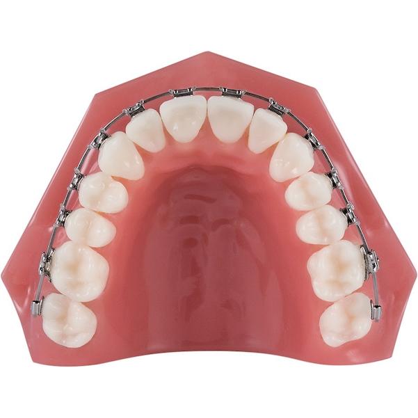 TruFlex™ Thermoelastische Nickel-Titan Drahtbögen - Euro-Form, rund, geätzt