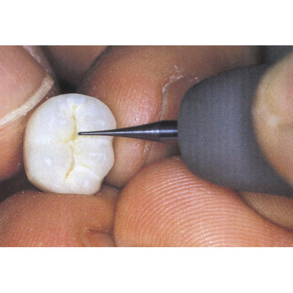 Hartmetallbohrer, Fissurenzieher rund