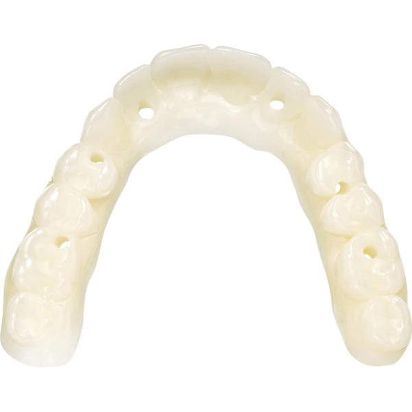 KeyDenture Try In™